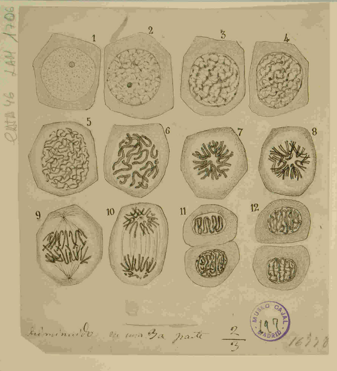 Células epiteliales en vías de división cariocinética de la piel. Muestra el proceso de mitosis (división celular), que es el motor tanto de la regeneración de tejidos (ligado a sus "corpúsculos germinales") como de la proliferación descontrolada del cáncer. URL: http://simurg.csic.es/view/9918477553904201/
