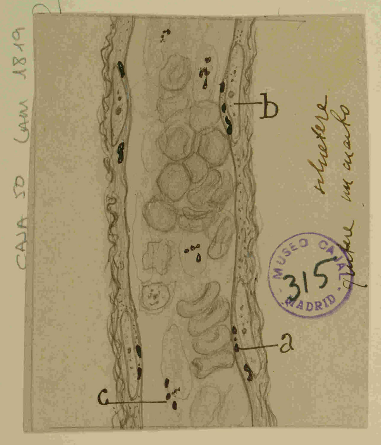 Dibujo científico de un corte histológico, mostrando una sección de tejido con células y estructuras celulares identificadas, usado para ilustrar conceptos en biología y patología.