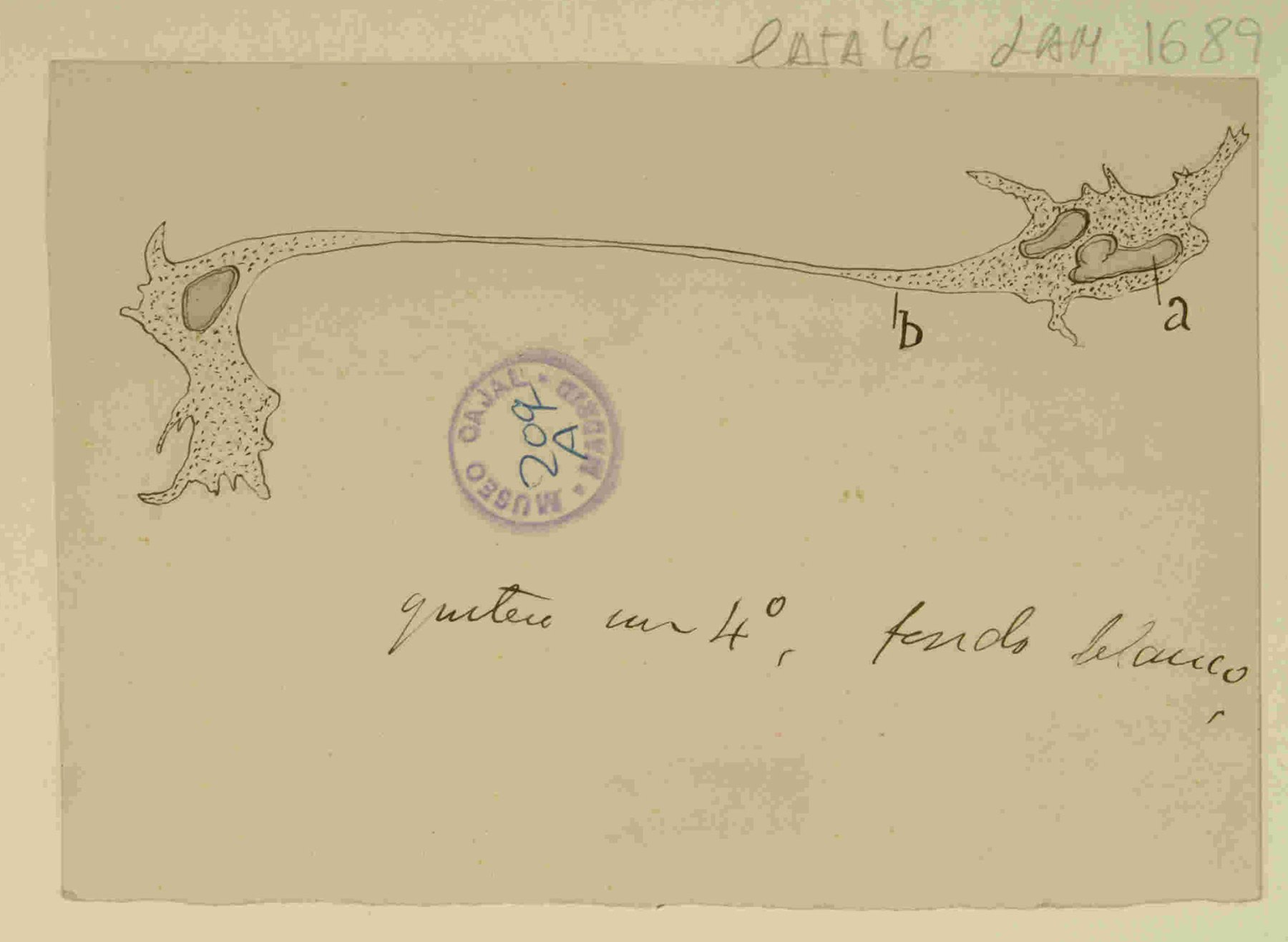 Leucocito en vías de escisión de sangre viva de pleurodelo waltii". Este dibujo de Santiago Ramón y Cajal es una obra maestra que captura la secuencia dinámica de la diapédesis. Muestra la extrema plasticidad de un leucocito mientras atraviesa la barrera endotelial, una observación fundamental que sentó las bases de su paradigma sobre la individualidad y el dinamismo celular. URL: http://simurg.csic.es/view/9918477705504201