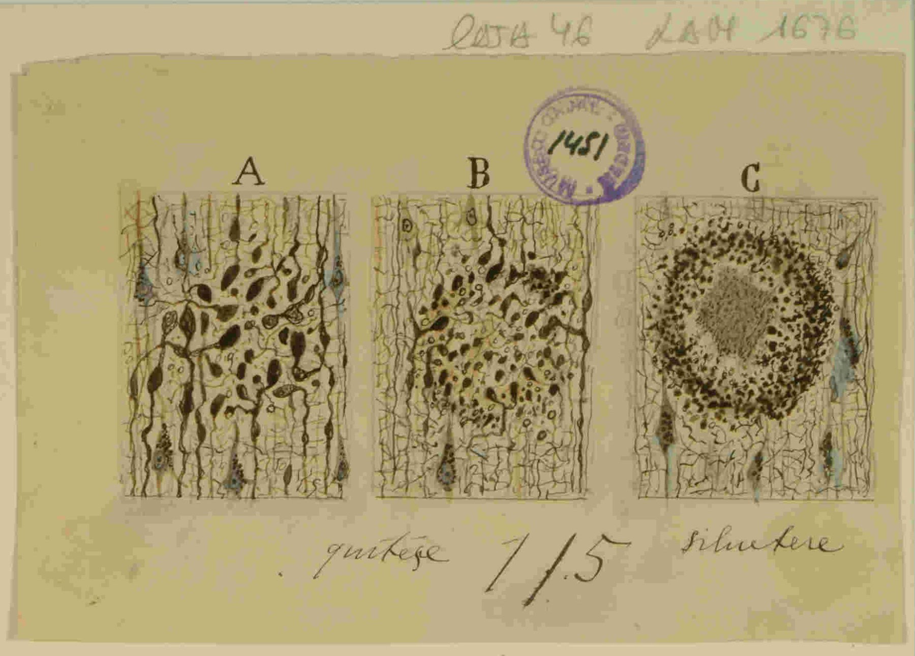 Dibujo científico de Santiago Ramón y Cajal, las placas seniles de la corteza cerebral de un viejo atacado de demencia. / Santiago Ramón y Cajal. 9918477719304201. http://simurg.csic.es/view/9918477719304201/