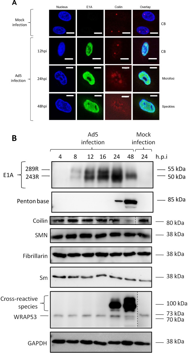 Figure 6: The hijacking of the Cajal Body by Adenovirus 5 (Ad5). (A) Immunofluorescence images showing the reorganization of the coilin protein (red) in infected cells. In uninfected cells (Mock), coilin concentrates in defined Cajal Bodies (CBs). After Ad5 infection, CBs are dismantled and coilin is redistributed into "microfoci" and "speckles" in the late phase (48 hpi). (B) Western blot confirming that the levels of major CB proteins, such as Coilin and SMN, remain stable during the reorganization, demonstrating that this is hijacking rather than degradation. (Credit: White, L.; Erbay, B.; Blair, G.E. mBio 2023, 14, e01459-e01482. CC BY 4.0)