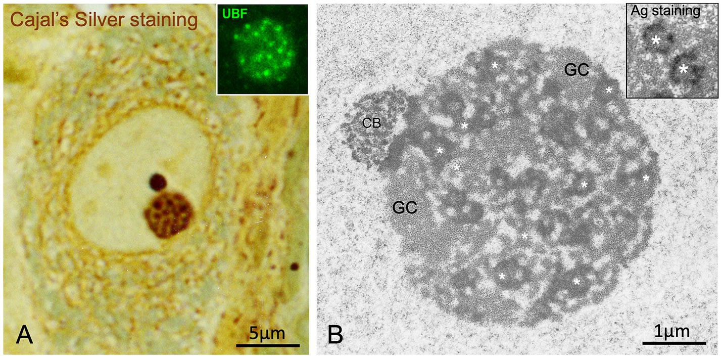 Image A: Neuronal tissue sample stained with Cajal's silver nitrate, showing the nuclear structure with dark spheres (Cajal Body).