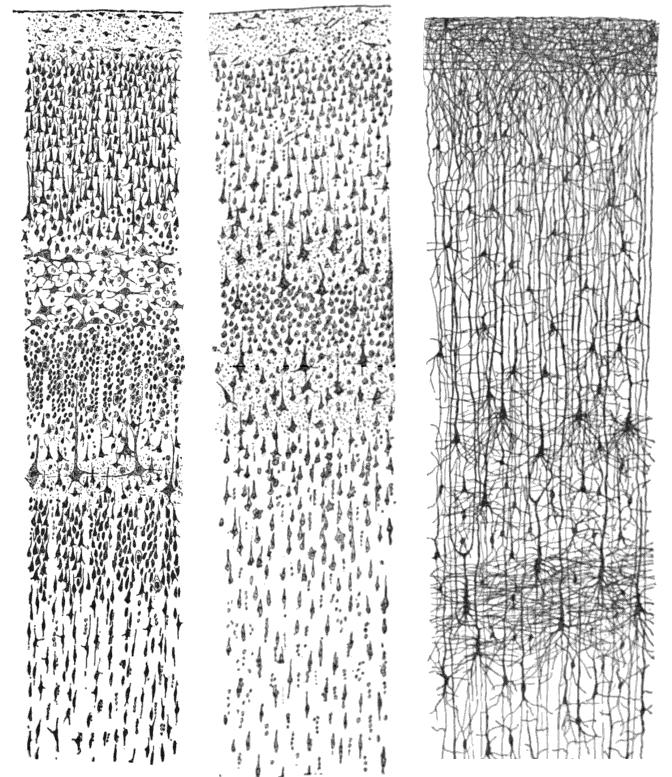 Three sections of a black-and-white diagram showing different patterns of lines and dots, possibly representing cellular structures or neuronal connections.