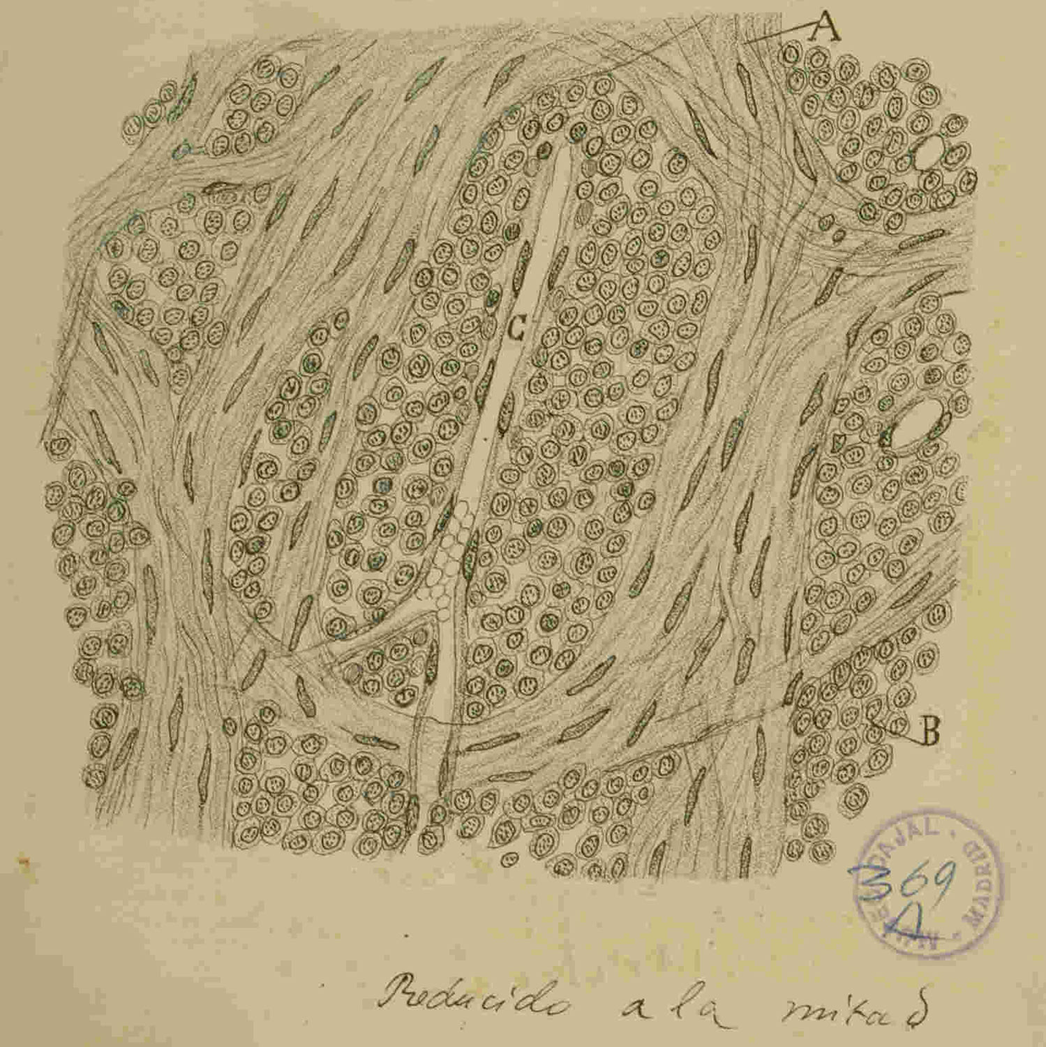 La Otra Doctrina: Santiago Ramón y Cajal y los Fundamentos de la Oncología Moderna