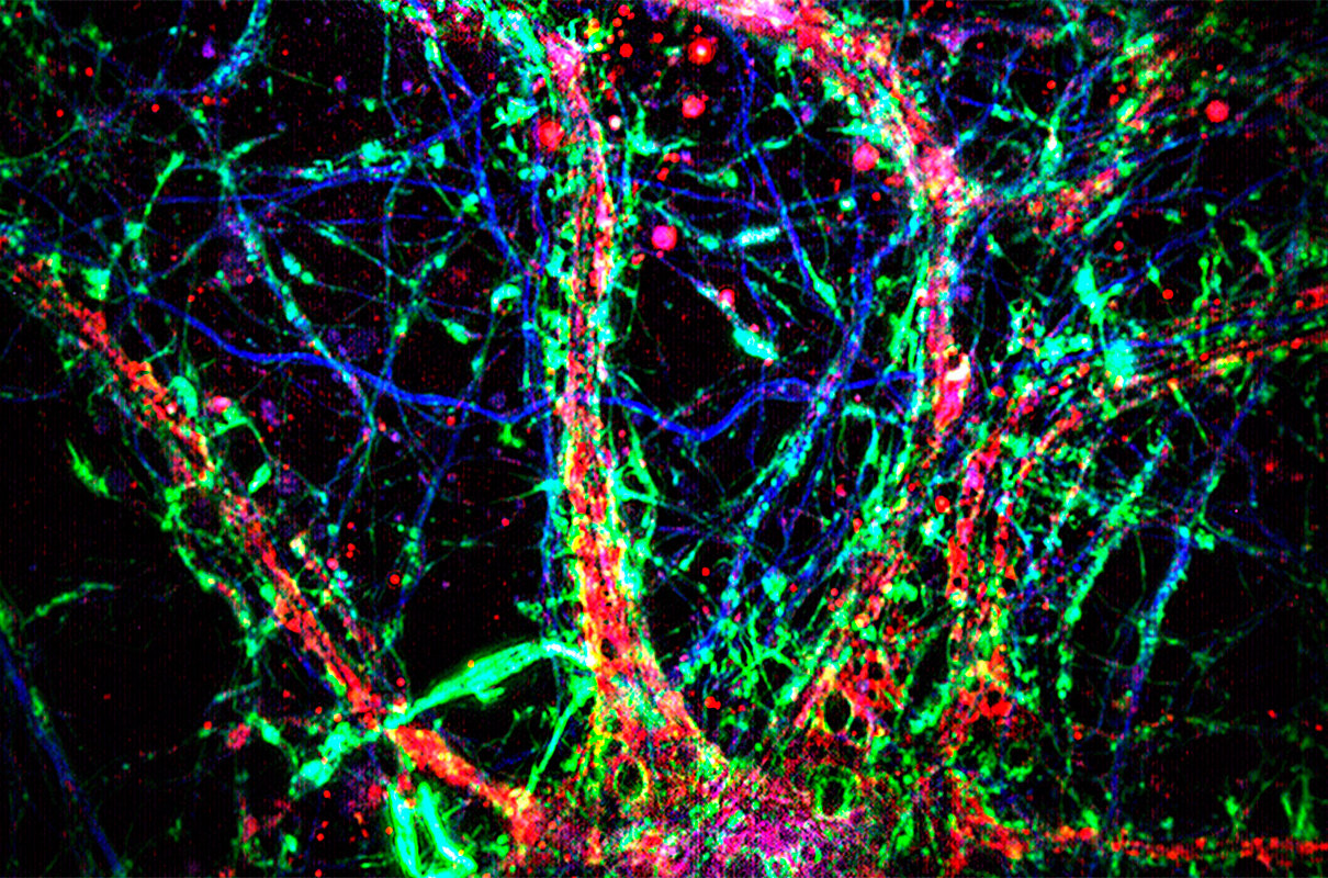 El Jardín Interconectado