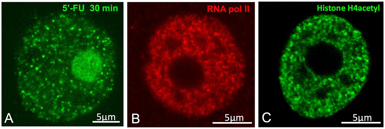 Microscopy images showing nuclear structures in cells: A) RNA visualisation with 5-FU