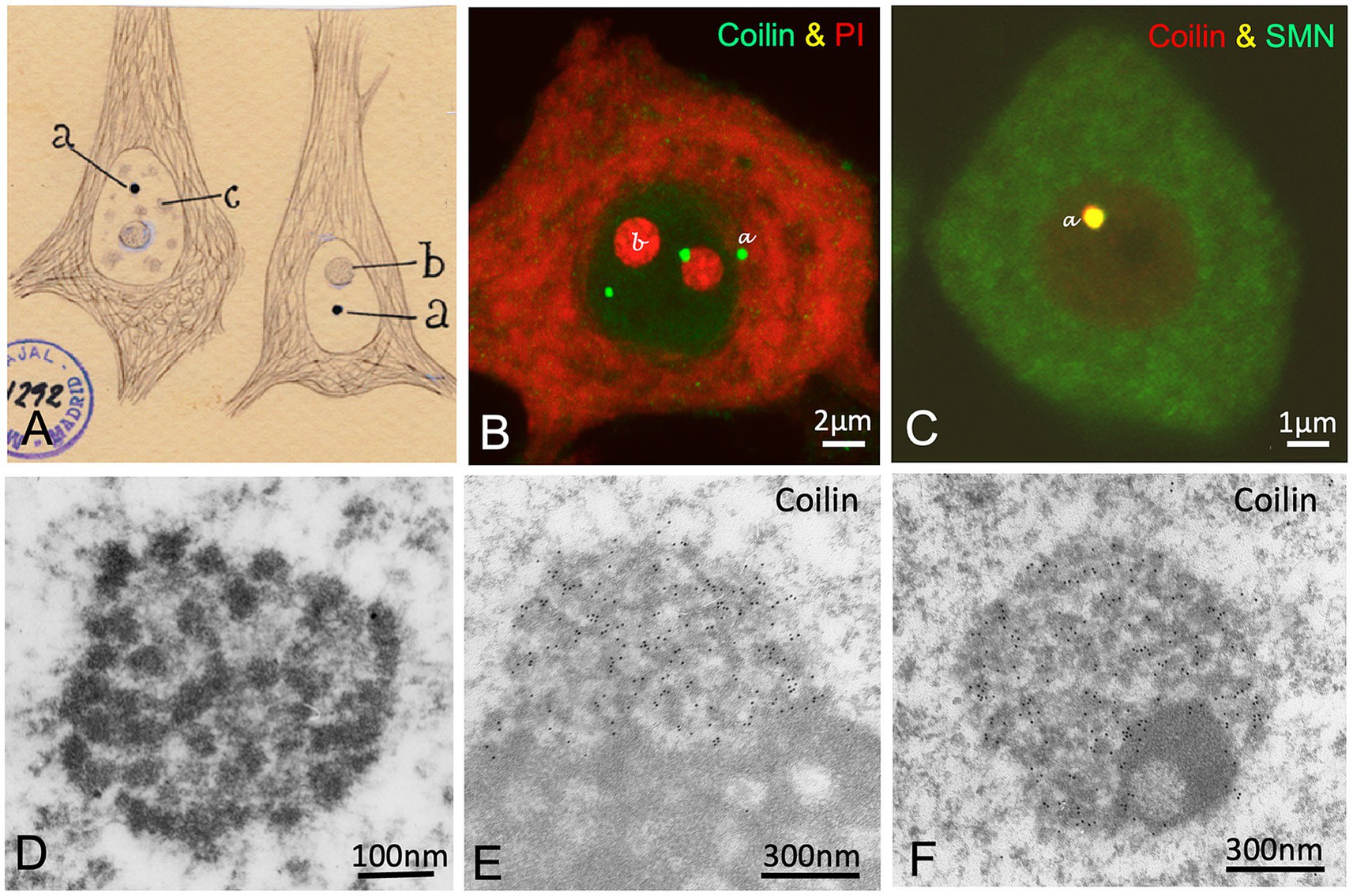 Figure 5: The accessory body (Cajal Body) (A) Cajal's original drawing of accessory bodies (a) stained with silver in pyramidal neurons. Note the sharpness of the cytoskeletal neurofilaments. (B) Immunolabelling of Cajal Bodies with coilin (green) and RNA counterstain with propidium iodide (red) in a motor neuron. (C) Colocalisation of Coilin and SMN in a Cajal Body; SMN is the deficient protein in Spinal Muscular Atrophy (SMA). (D) Ultrastructure of a Cajal Body showing its two subcomponents: electron-dense threads and an amorphous matrix. (E, F) Electron microscopy (Immunogold) detecting coilin specifically on the dense threads of the body, both in its nucleolus-associated form (E) and free in the nucleoplasm (F). (Source: Adapted from Lafarga et al., 2025).
