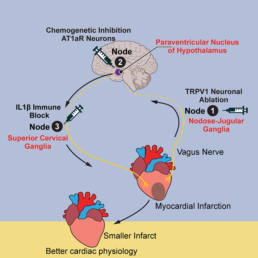 A three-node neuroimmunal circuit between heart and brain underlying myocardial infarction