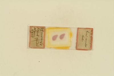 Histological preparation. Método de hematoxilina and eosina. Original tray "glandular". / M. Heidenhain.