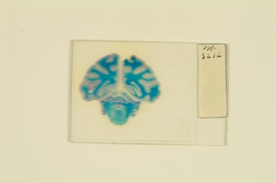 Preparación histológica moderna?. Cerebro de mono. Método de Nissl.