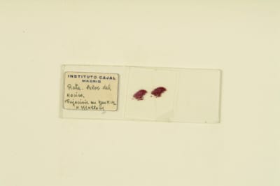 Histological preparation. Rata, pelos del hocico. Método de Mallory. / Cajal School.