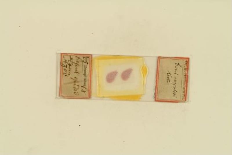 Histological preparation. Método de hematoxilina and eosina. Original tray "glandular". / M. Heidenhain.