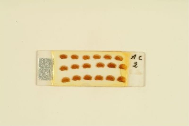 Histological preparation by Francisco Tello. Mouse. / Cajal School. Francisco Tello.