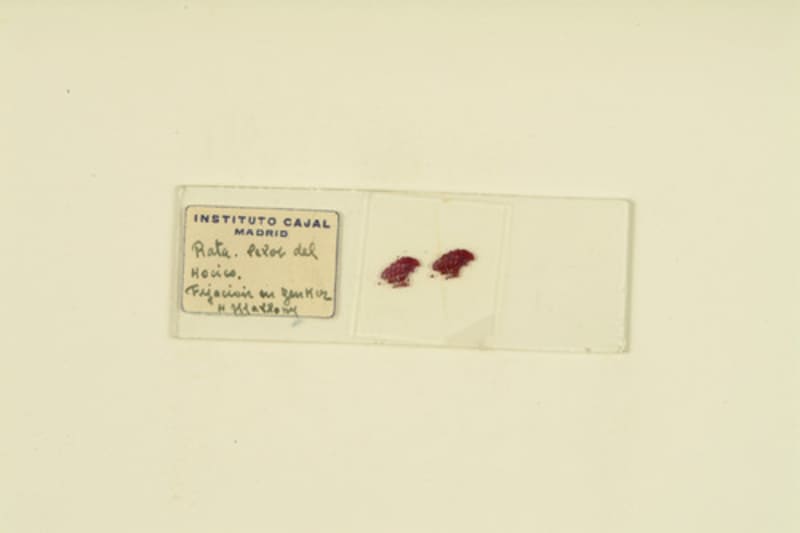 Histological preparation. Rata, pelos del hocico. Método de Mallory. / Cajal School.