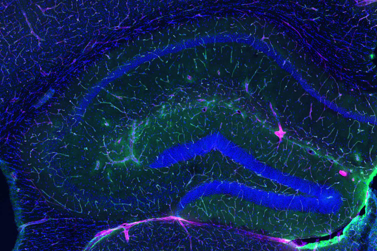 Modulación sistémica de la neurodegeneración